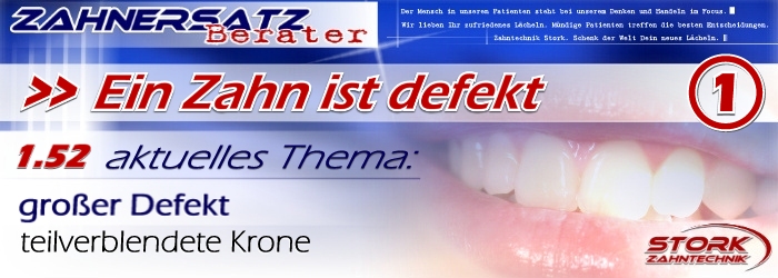 Ein Zahn ist defekt
